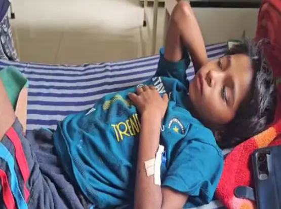 AMBIKAPUR NEWS : हेडमास्टर की पिटाई से मासूम का पैर फ्रैक्चर